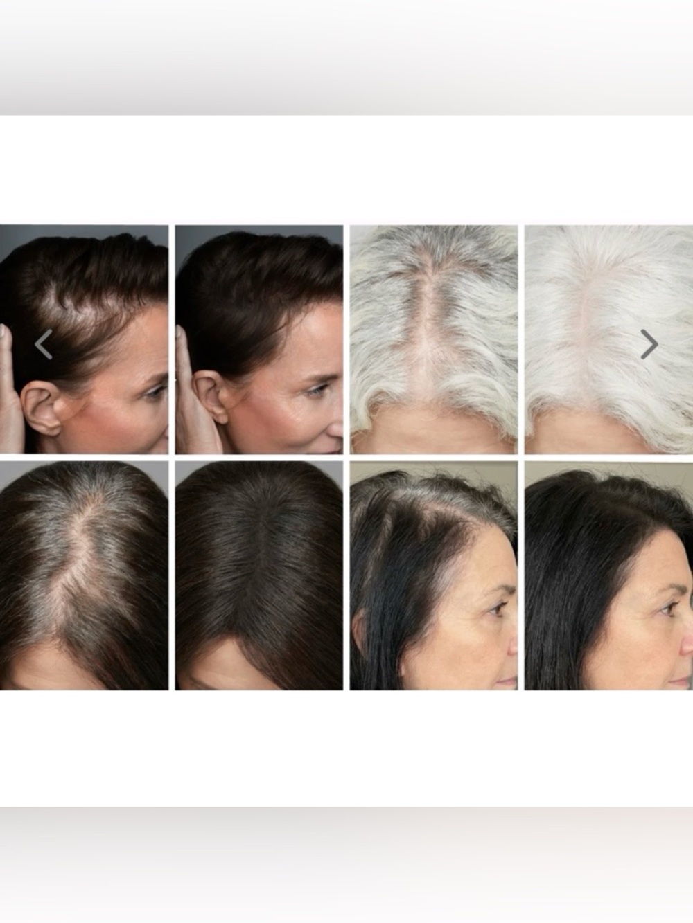 🔥PRIME PROMETICS🔥Instant Coverage Hairline Powder - Silver Queen - Picture 4 of 5